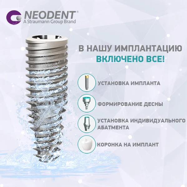 Технология установки NeoDent