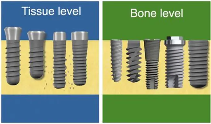 Bone-level vs Tissue-level