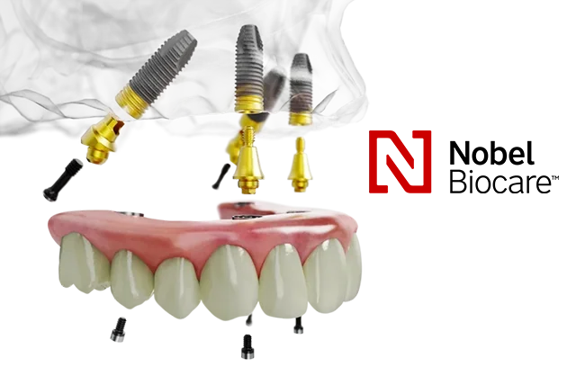 Схема all-on-4 от Nobel Biocare
