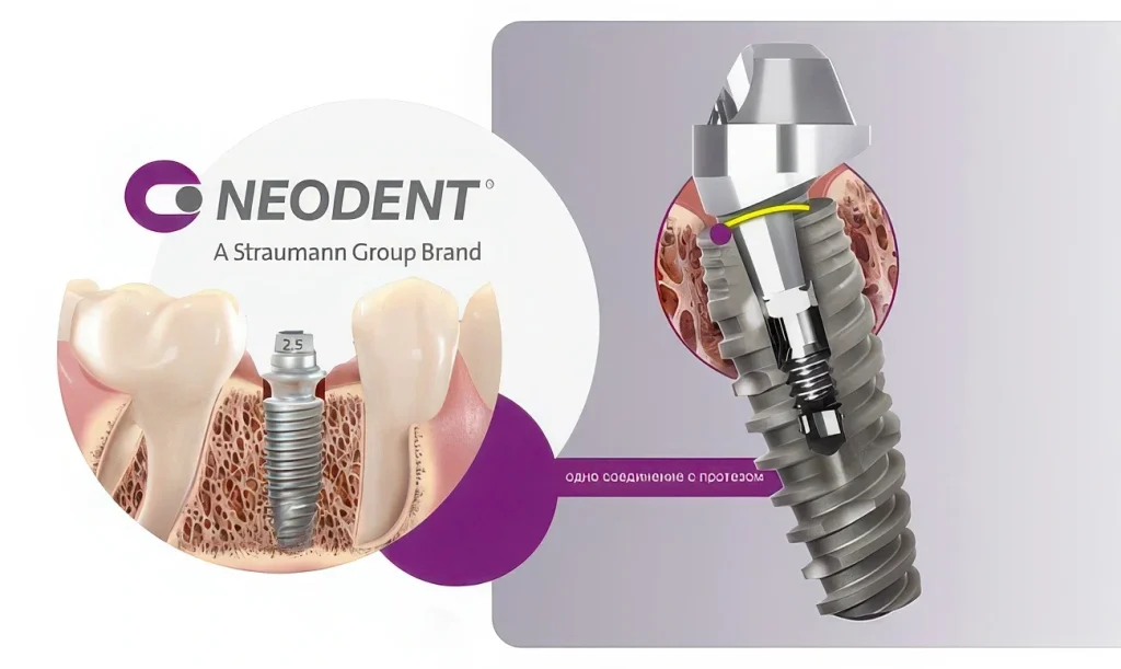 Имплантат Neodent