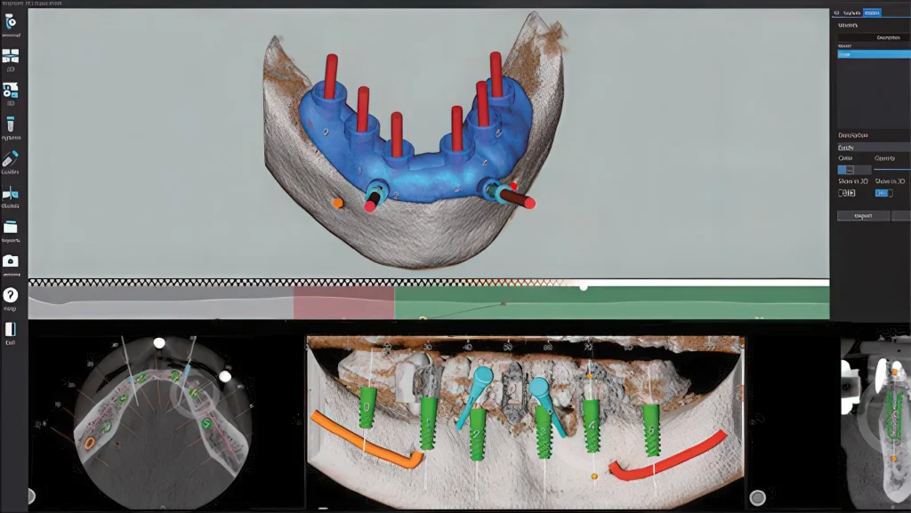 втулки для шаблонов